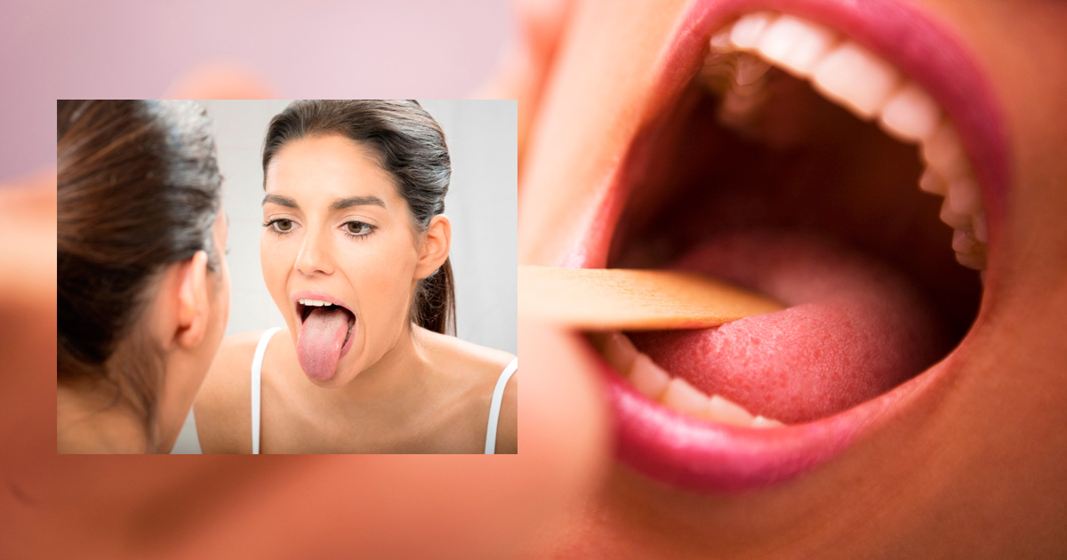 Is Your Tongue Trying To Tell You Something About Your Health?