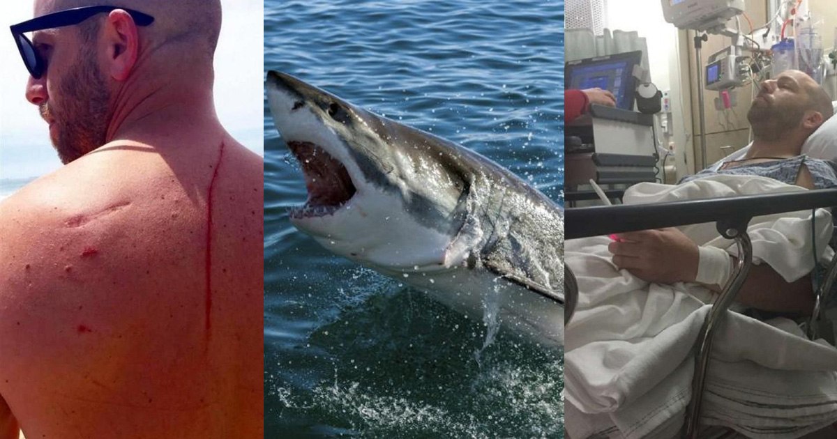 Man Has A Run In With A Shark That Ultimately Saves His Life