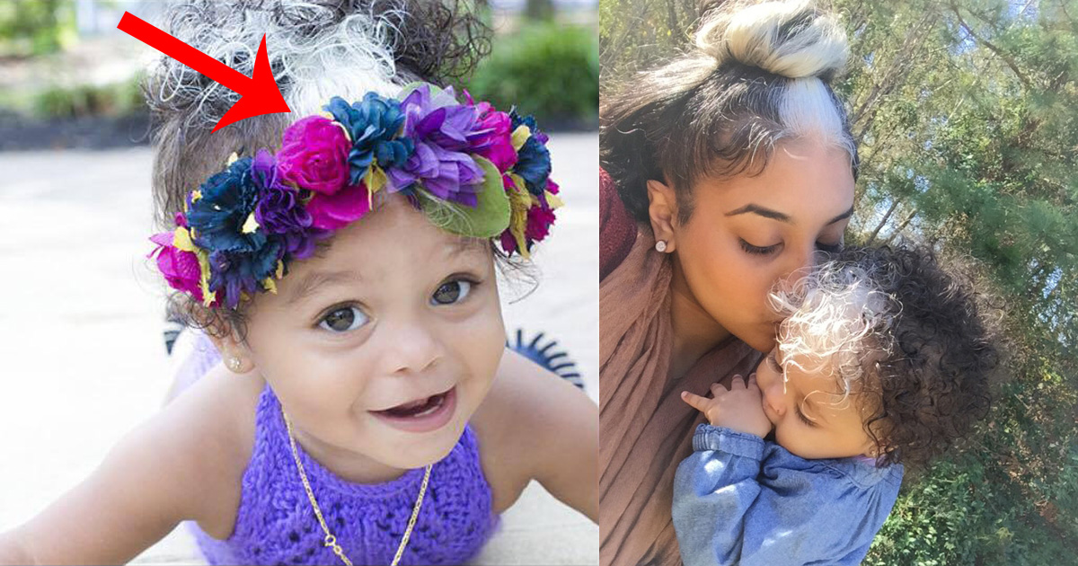 Baby Girl Inherits Stunning Genetic Trait From Her Mom 