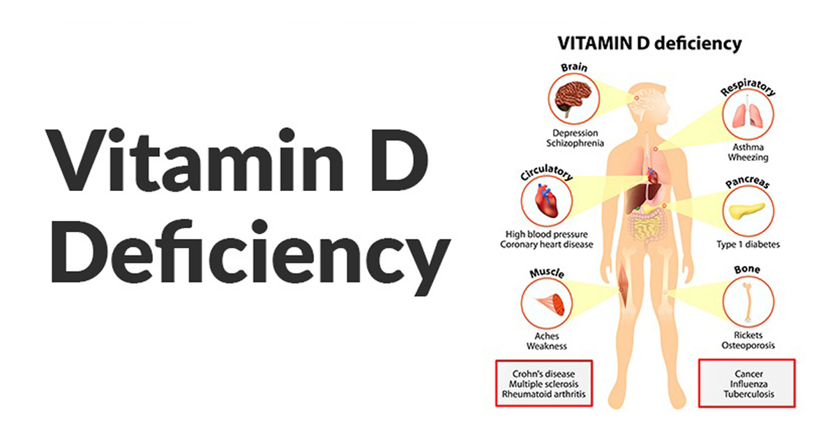 Study Shows That Vitamin D Is Integral To Your Health And Many Are Chronically Deficient 