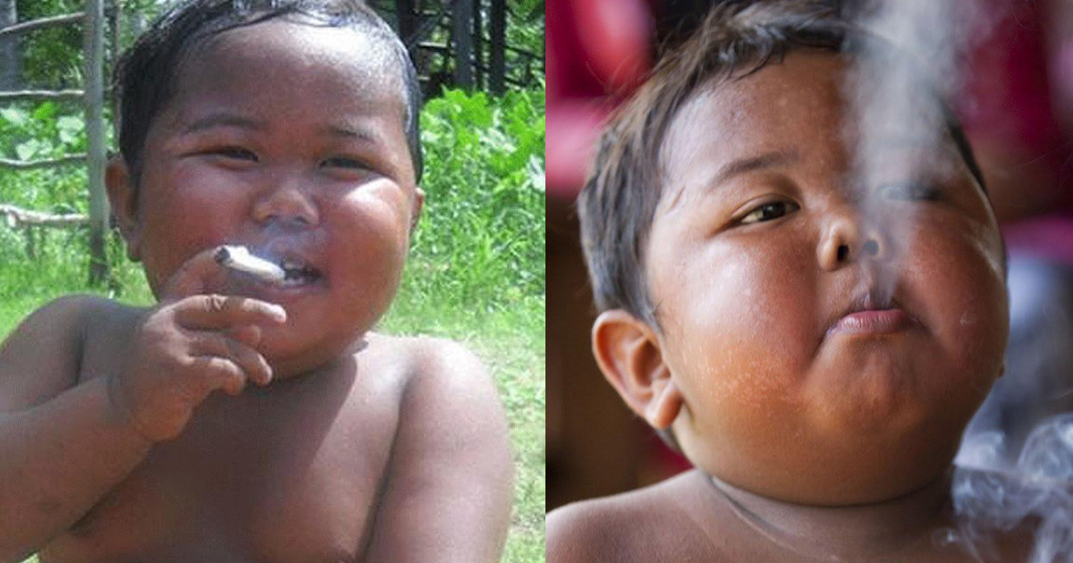 This Is What 8 Years Did To The Boy Who Smoked 40 Cigarettes A Day