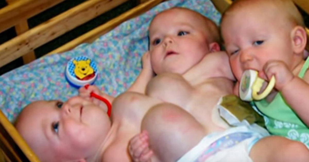 Rarest Triplets In The World Reveal What They Look Like Now