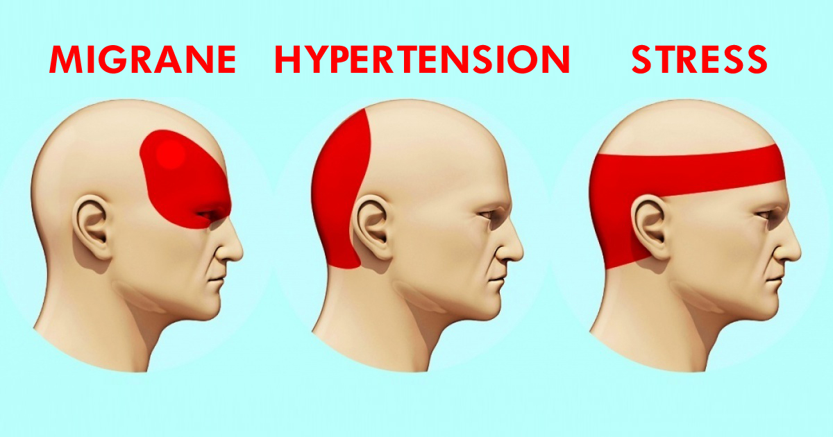 Get Rid Of A Headache In 5 Minutes Flat Without Painkillers