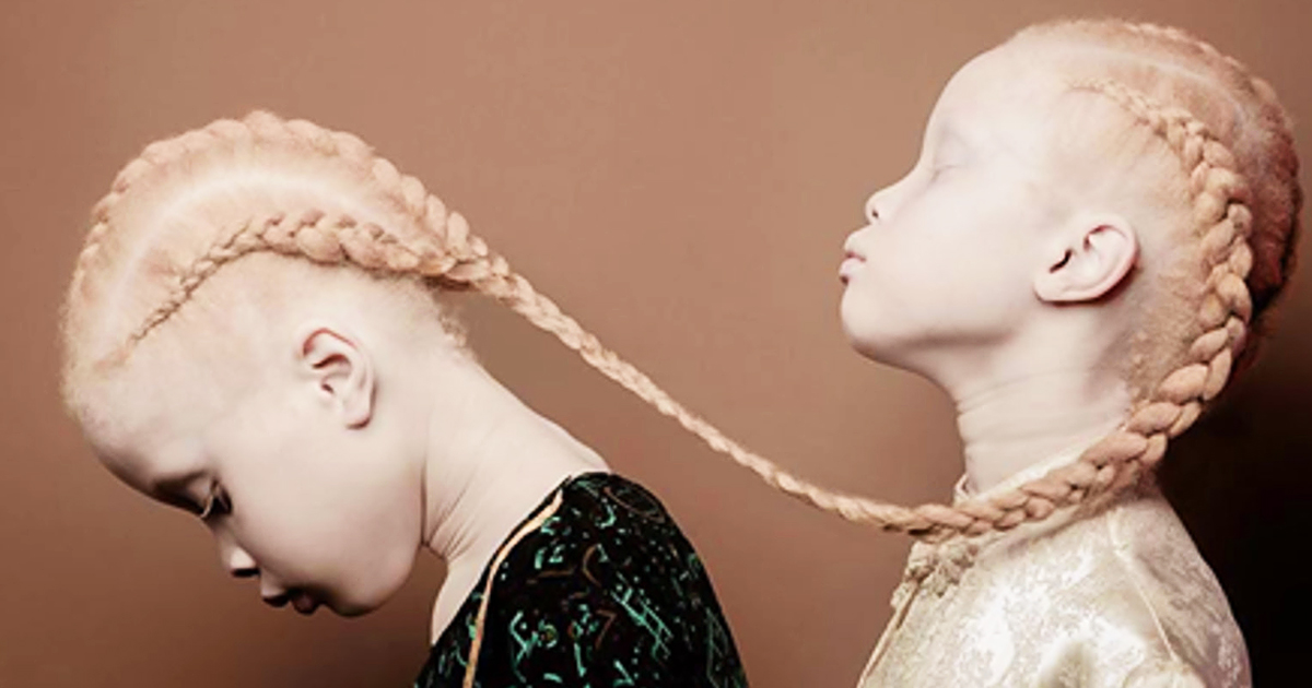 These Brazilian Albino Twins Are Dominating The Fashion Industry With Their Compelling Beauty 