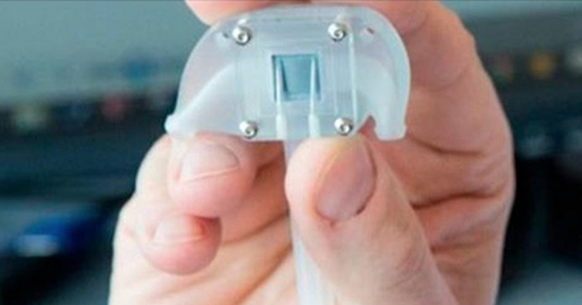 Dialysis Machines No More! Scientists Have Created A Bionic Kidney!