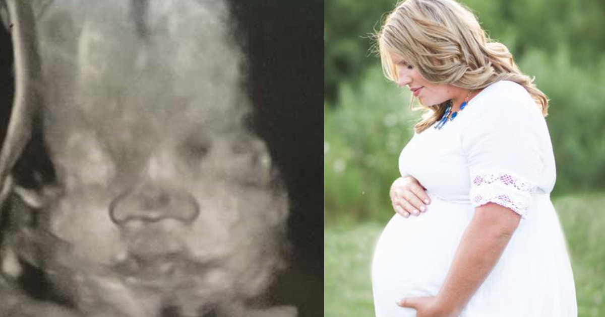 Wife Discovers She’s Pregnant At Her Husband's Funeral—25 Weeks Later, Her Doctor Delivers Unbearable News