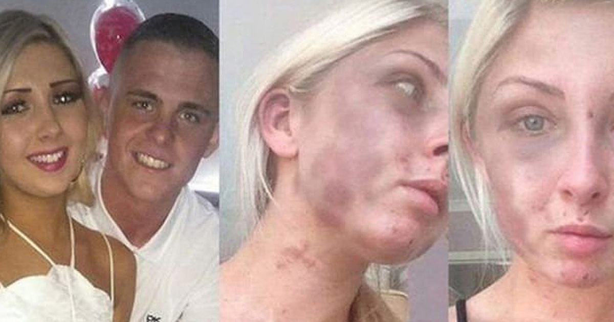 The World Is Horrified When They Found Out Why This Man Beat His Girlfriend Senseless