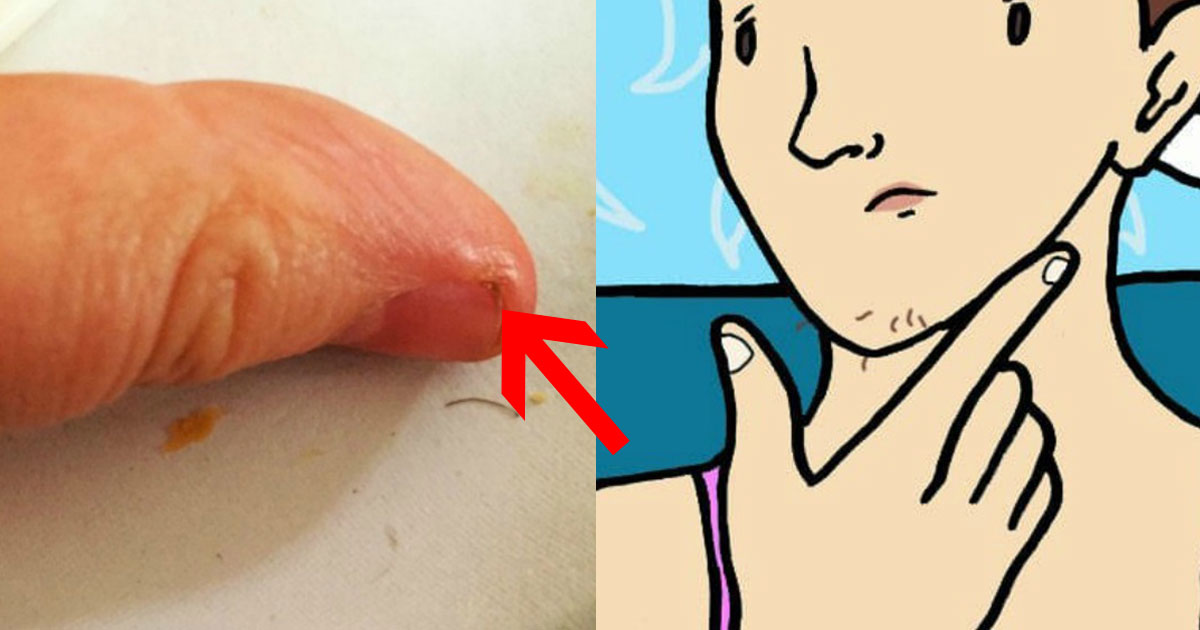 The Truth About Female Chin Hair And The 7 Embarrassing Red Flags No Woman Should Ever Ignore