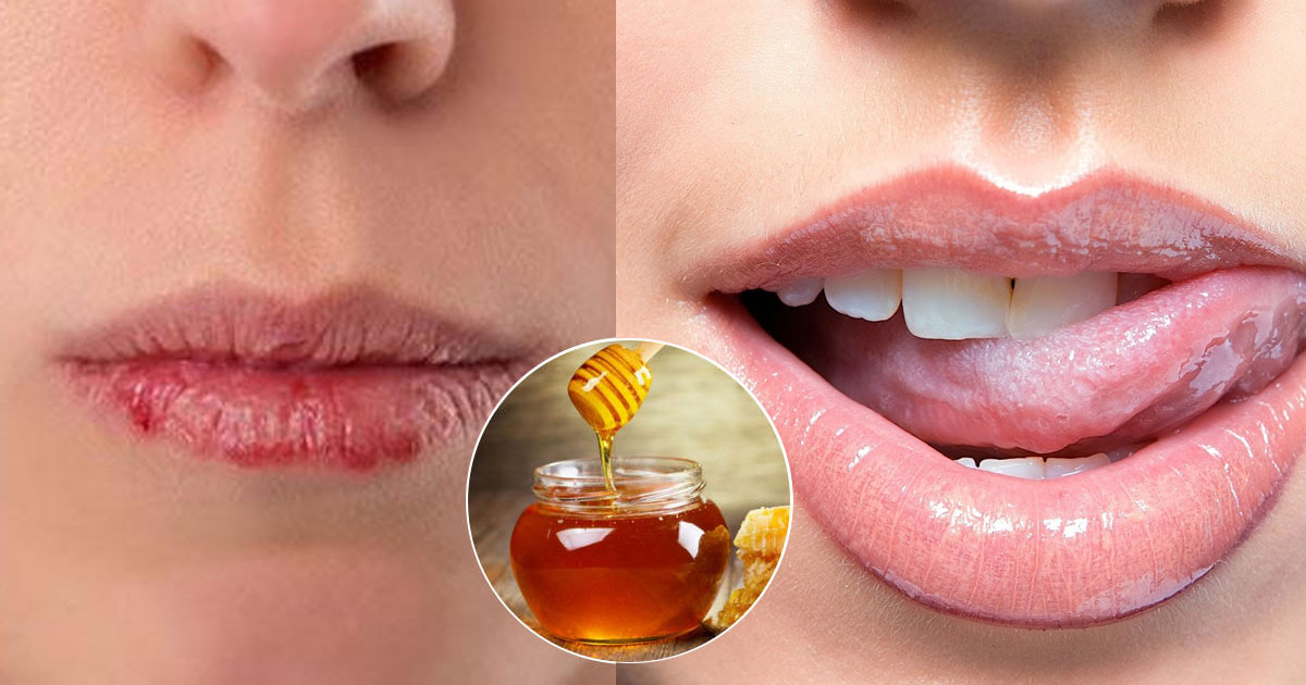 10 Easy Tips To Make Your Lips Instantly Kissable