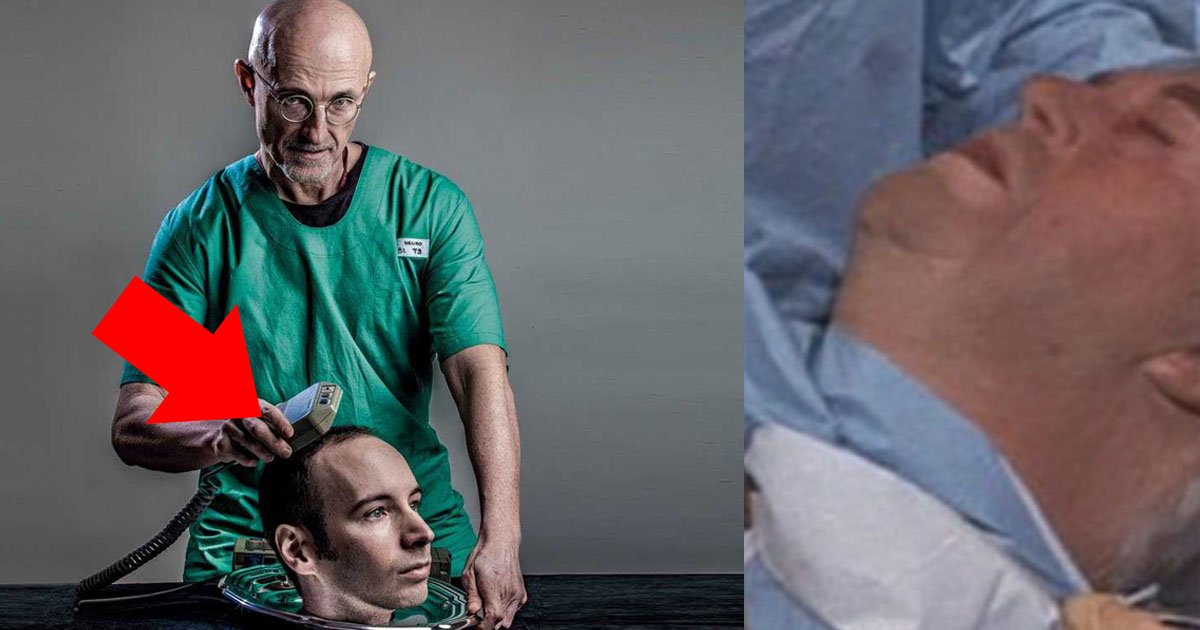 Controversial Doctor Believes We Will See The First Successful Human Head Transplant In 2017