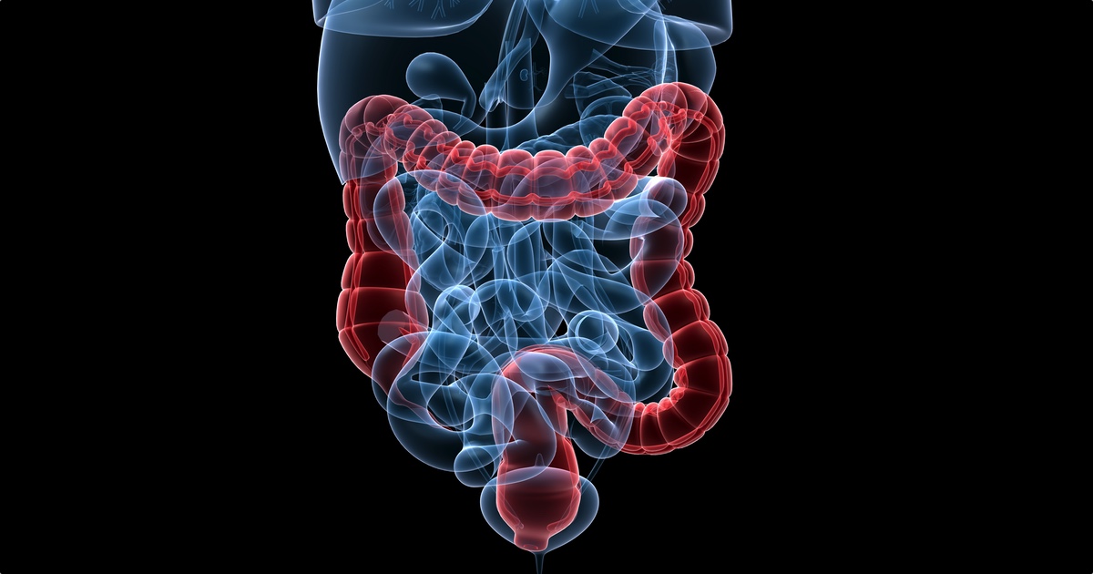 How To Remove Pounds Of Toxic Waste From Your Colon And Cleanse Your System